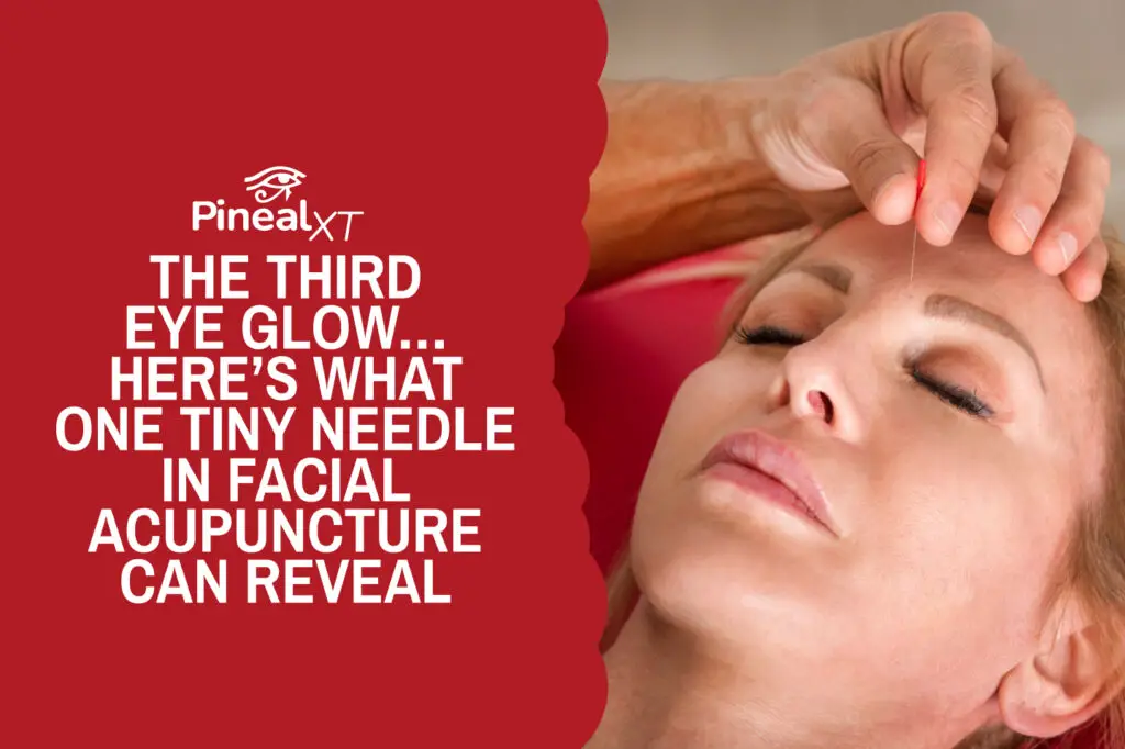 The Third Eye Glow… Here’s What One Tiny Needle in Facial Acupuncture Can Reveal